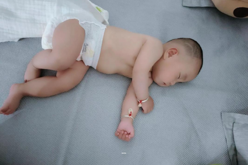 遵义宝宝脸上有白色斑块 遵义宝宝脸上有白色斑块